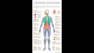 Understanding Brunner Syndrome A Rare Genetic Disorder [upl. by Mcnelly]