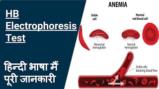 Hb Electrophoresis test in hindi part 2 [upl. by Adnalu]