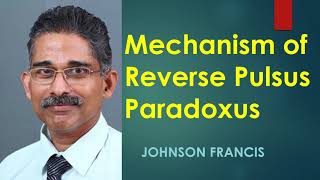 Mechanism of Reverse Pulsus Paradoxus [upl. by Lenzi]