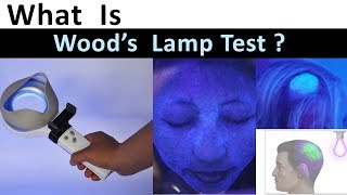 What is Woods Lamp Test [upl. by Gawen]