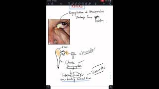 Case 8 Corneal Ulcer  The 10 Essentials to Do [upl. by Waiter]