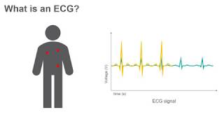 ECG Circuit  Project Lab 3 [upl. by Cogn516]