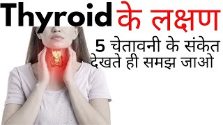 Thyroid ke lakshan kya hai  Thyroid symptoms in Hindi [upl. by Erdrich]