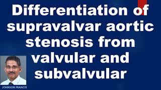 Differentiation of supravalvar aortic stenosis from valvular and subvalvular [upl. by Critta]