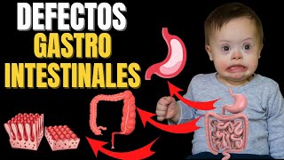 🔴Las 7 alteraciones gastrointestinales MÁS FRECUENTES en el Síndrome de Down☺️ [upl. by Justis]