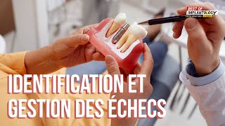 Identification et gestion des échecs en implantologie  Conférence Best of Implantology Dr Messica [upl. by Snebur]