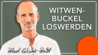 Witwenbuckel selbst behandeln [upl. by Xet]