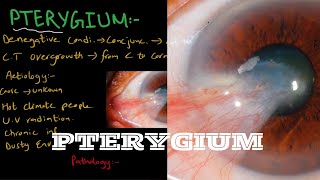 What is PTERYGIUM   Pseudoterygium  Very Important [upl. by Allicserp]