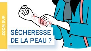 Zoom Sur  La dermatite atopique une maladie inflammatoire chronique de la peau  Uriage [upl. by Aynik]