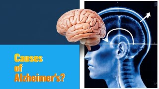 Whats REALLY Causing ALZHEIMERS Disease [upl. by Ynettirb]