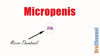 Stop Micropenis Concerns  UroChannel [upl. by Nekcerb]