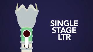 Laryngotracheal Reconstruction LTR What You Need to Know [upl. by Dominy655]