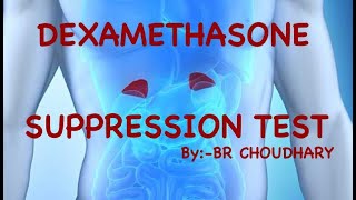 DEXAMETHASONE SUPPRESSION TEST CUSHING DISEASE  CUSHING SYNDROME  DEXAMETHASONE STRESS TEST [upl. by Julianne353]