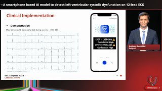 A smartphonebased AI model to detect left ventricular systolic dysfunction on ECG  ESC London 2024 [upl. by Enened]