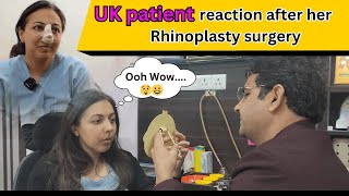 Transformative rhinoplastydiary Journey Dr Sunil Tanvar Consults His UK Patient [upl. by Lein]