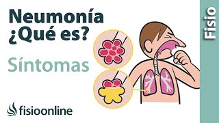 ¿Qué ES la NEUMONÍA y Cuáles son los SÍNTOMAS y CAUSAS🤔 [upl. by Irap]