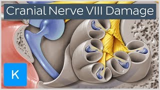 What happens when the vestibulocochlear nerve is damaged  Human Anatomy  Kenhub [upl. by Talich]