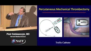 Interventional Therapies for Venous Thromboembolism  Piotr Sobieszczyk MD [upl. by Nereen]