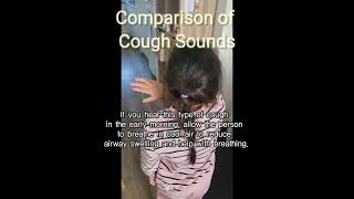 If you hear this kind of cough sound first have them breathe in cold airㅣCroup cough sound [upl. by Aihsekal]