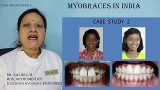 Myobrace case presentation 2 [upl. by Dobson]