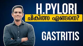 Hpylori ചികിത്സ എങ്ങനെ  Dr Sijil K S [upl. by Malca]