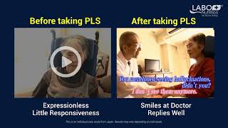 NeuroREGAIN See the difference before and after taking Neuroregain scallopderived plasmalogens [upl. by Aisekal516]