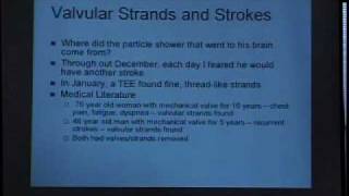 Prosthetic Aortic Valve Valvular Strands Stroke TEE [upl. by Rettig]