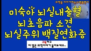 미숙아 뇌실내출혈 두개내 출혈과 뇌실주위 백질연화증periventricular leukomalacia [upl. by Kotz366]