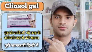 Clinsol gel use benefits and side effects full review in hindi [upl. by Zared396]