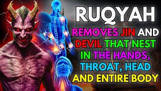 MIRACLE RUQYAH REMOVES JINN AND DEVIL THAT NEST IN THE HANDS HEAD TROATH AND ENTIRE BODY [upl. by Iat]