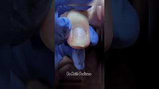 Cute nails satisfying pedicure nails pedicure satisfying [upl. by Agna280]