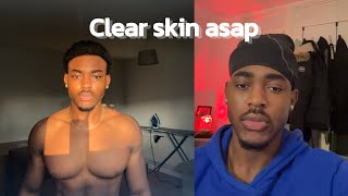 How to get clear skin for guys [upl. by Nwadrebma]