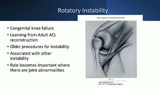 Hypoplasia of femoral condyle approach amp management  N Nicolaou [upl. by Gerstner]