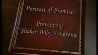 Shaken Baby Syndrome [upl. by Jemy]