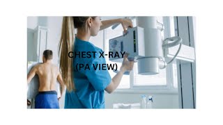 Chest xray pt 1 PA view [upl. by Jacques]