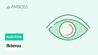 Differentialdiagnostik des Ikterus  AMBOSS Auditor [upl. by Wise890]