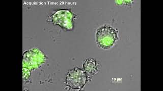 Macrophage Phagocytosis ROS microscopy live cell imaging Time lapse [upl. by Caruso733]