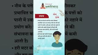 चेचक के लक्षण और घरेलू उपचार  Chickenpox symptoms and home remedies [upl. by Kirenoj112]