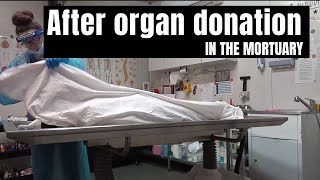 In the mortuary after organ donation [upl. by Atika]