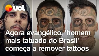 Homem mais tatuado do Brasil vira evangélico e começa a remover tatuagens vídeos mostram processo [upl. by Anined]