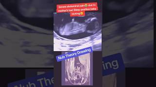 Baby Abdominal pain due to mother wrong sleep position😭viralvideo trending viralshorts [upl. by Hong947]