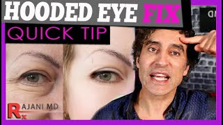 THE BROW LIFT EXPLAINED  Botox Brow Lift [upl. by Neelyar]