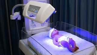 Phototherapy Treatment For Jaundice  Phototherapy In Newborn  Phototherapy Treatment [upl. by Redliw]