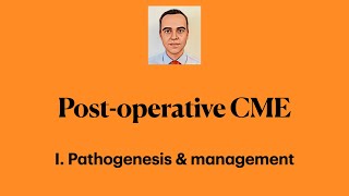 Postoperative Cystoid Macular Edema I Pathogenesis amp management [upl. by Ahcsrop]