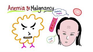 Anemia and Malignancy [upl. by Ashlan541]