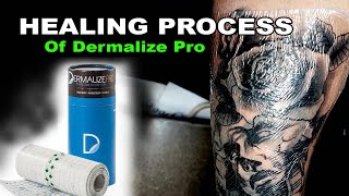 Healling Process of Dermalize Pro [upl. by Aseral]