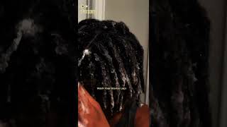 How to Take Care of Your Starter Locs for Longevity shorts [upl. by Annerol]