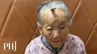 107YearOld Woman in Guangdong Develops Rare quotLongevity Hornquot on Her Forehead  PHJ [upl. by Uolymme]