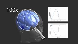 Impedance Change of Brain Pulsation [upl. by Asirap]