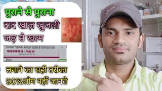 Terbinaforce plus nf cream use benefits and Side effects full review in hindi [upl. by Enitsirt455]